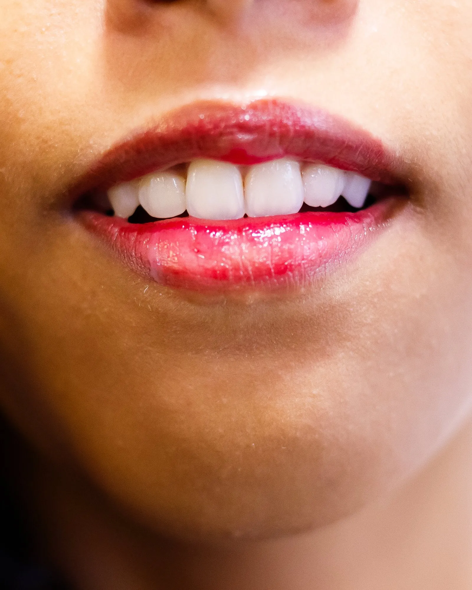 Sorriso de paciente do Consultório Cousin