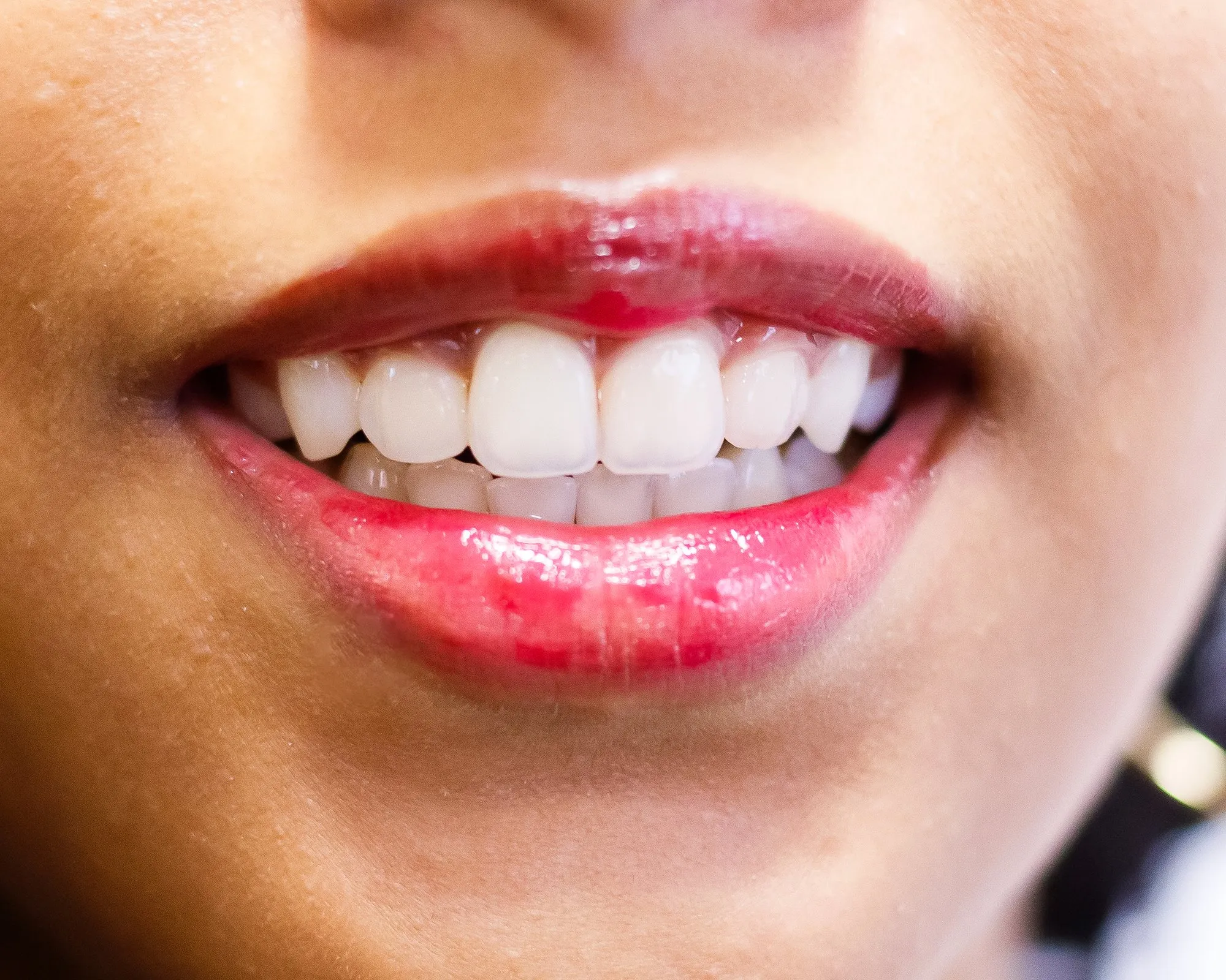 Sorriso de paciente do Consultório Cousin