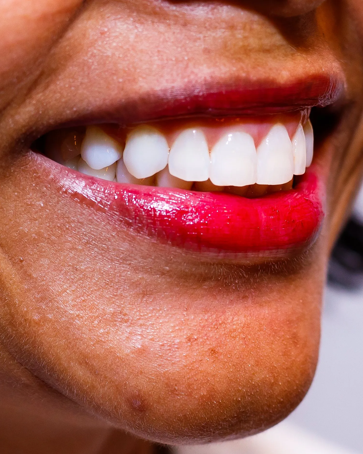Sorriso de paciente do Consultório Cousin